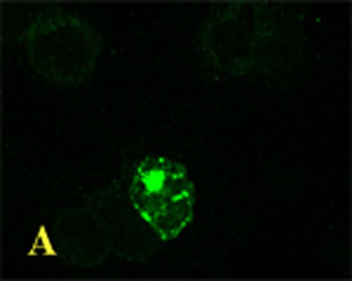 Rabbit Anti-Microtubule-Associated Proteins 1A/1B Light Chain 3A (MAP1LC3A)