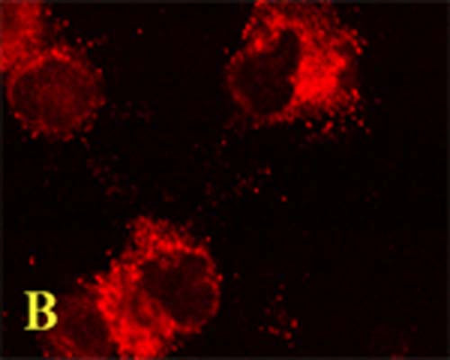 Rabbit Anti-Microtubule-Associated Proteins 1A/1B Light Chain 3A (MAP1LC3A)