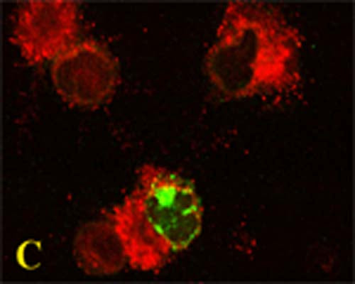 Rabbit Anti-Microtubule-Associated Proteins 1A/1B Light Chain 3A (MAP1LC3A)