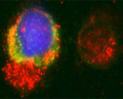 Rabbit Anti-Microtubule-Associated Proteins 1A/1B Light Chain 3A (MAP1LC3A)