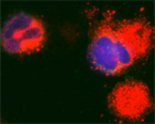 Rabbit Anti-Microtubule-Associated Proteins 1A/1B Light Chain 3A (MAP1LC3A)