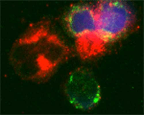 Rabbit Anti-Microtubule-Associated Proteins 1A/1B Light Chain 3A (MAP1LC3A)