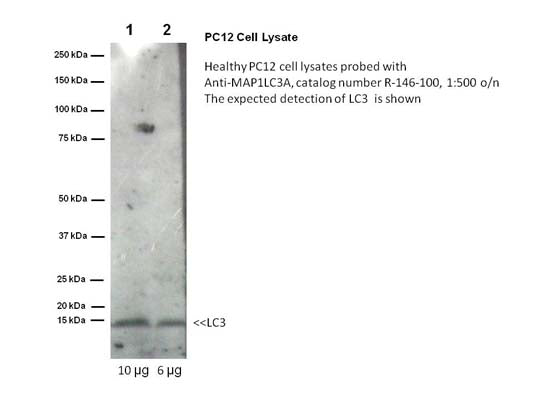 Rabbit Anti-Microtubule-Associated Proteins 1A/1B Light Chain 3A (MAP1LC3A)