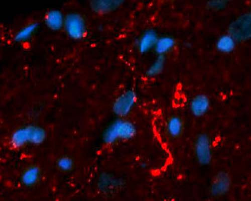 Rabbit Anti-Neurotensin (NT)