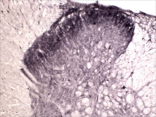 Rabbit Anti-Tyrosine Kinase Receptor A (TrkA)