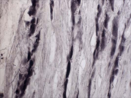 Rabbit Anti-Tyrosine Kinase Receptor A (TrkA)