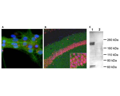 Rabbit Anti-Adenylate Cyclase Type III (ACIII)