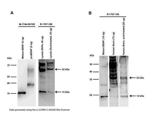 Rabbit Anti-Brain-Derived Neurotrophic Factor (BDNF)
