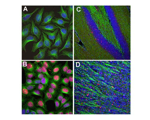 Rabbit Anti-Cellular Oncogene FOS (c-FOS)