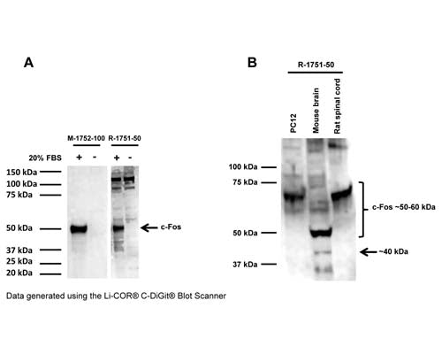 Rabbit Anti-Cellular Oncogene FOS (c-FOS)