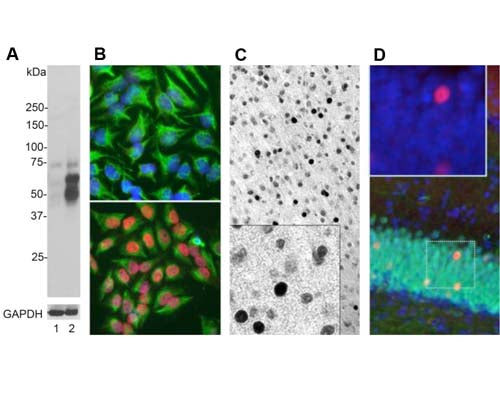Rabbit Anti-Cellular Oncogene FOS (c-FOS)