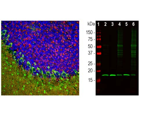 Rabbit Anti-Beta-Synuclein