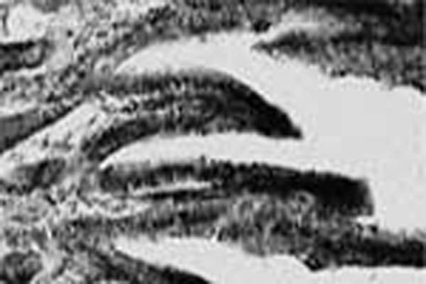 Sheep Anti-Neurturin (NTN)