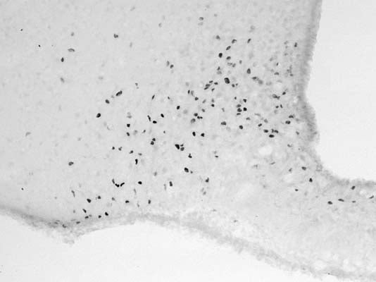 Sheep Anti-Cellular Oncogene FOS (c-FOS)