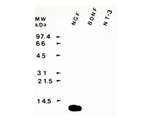 Sheep Anti-Beta-Nerve Growth Factor (Beta-NGF)