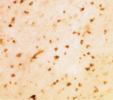 Sheep Anti-Alpha-Synuclein