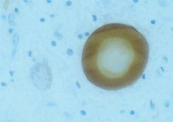 Sheep Anti-Alpha-Synuclein