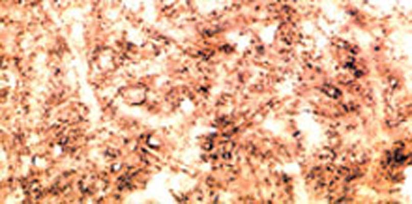 Sheep Anti-Beta-Synuclein