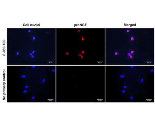 Sheep Anti-Pro-Brain-Derived Neurotrophic Factor (proBDNF)