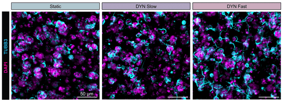 Representative maximum projection fluorescence images of hNPCs encapsulated at 3 × 104 cells/μl within all three gel formulations after 7 days of culture with labeled cell nuclei (DAPI, magenta) and neuritic extensions (TUBB3, 1:1000; cyan). Image from publication CC-BY-4.0. PMID:37862423