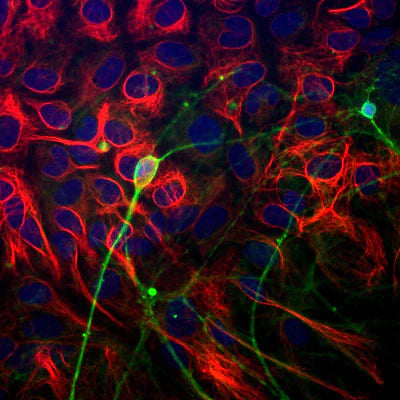 Immunostaining of paraformaldehyde-fixed (4%) neonatal mouse brain cultures showing β-Tubulin 3 immunostaining (green, 1:1000). Red staining is rabbit-anti-GFAP, blue is DAPI nuclear counterstain. Secondary antibodies were fluorescein-labeled goat anti-chicken IgY; Texas Red-labeled goat anti-rabbit IgG. Image from Dr.