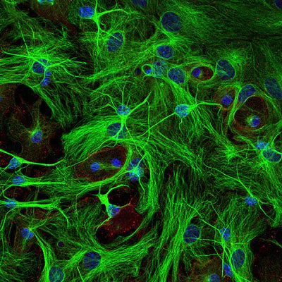 Immunostaining of paraformaldehyde-fixed (4%) cultures of SpH64 neuroblastoma cells showing β-Tubulin 3 immunostaining (green, 1:1000). Red staining is rabbit-anti-actin (1:1000); blue is DAPI nuclear counterstain. Secondary antibodies were fluorescein-labeled goat anti-chicken IgY 1:1000); Texas Red-labeled goat anti-rabbit IgG. Page Balisch (University of Arizona).