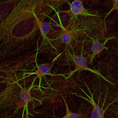 Immunostaining of paraformaldehyde-fixed (4%) cultures of SpH64 neuroblastoma cells showing β-Tubulin 3 immunostaining (green 1:1000). Red staining is rabbit-anti-actin (1:1000); blue is DAPI nuclear counterstain. Secondary antibodies were fluorescein-labeled goat anti-chicken IgY 1:1000); Texas Red-labeled goat anti-rabbit IgG. Page Balisch (University of Arizona).