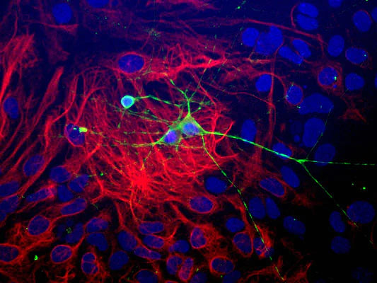 Immunostaining of paraformaldehyde-fixed (4%) neonatal mouse brain cultures showing β-Tubulin 3 immunostaining (green, 1:1000 dilution). Red staining is rabbit-anti-GFAP (1:1000); blue is DAPI nuclear counterstain. Secondary antibodies were fluorescein-labeled goat anti-chicken IgY; Texas Red-labeled goat anti-rabbit IgG Dr.