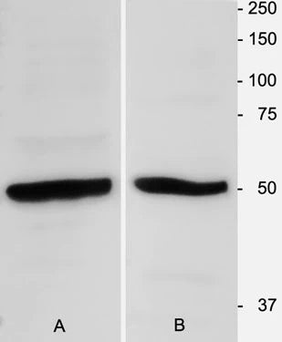 β-Tubulin 3 Immunoblot using homogenates of adult mouse brain (1:3000).