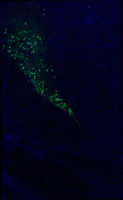 Immunostaining of adult mouse brain section fixed in 4% paraformaldehyde and preserved in cryoprotectant showing specific detection of tyrosine hydroxylase (1:500; green) in dopaminergic neurons of the substantia nigra. Nuclei stained with DAPI (blue). Background stain was attenuated with TrueVIEW. Image kindly provided by Ifeoluwa (Hiphy) Awogbindin of the Tremblay Lab, Division of Medical Sciences, University of Victoria, Canada.