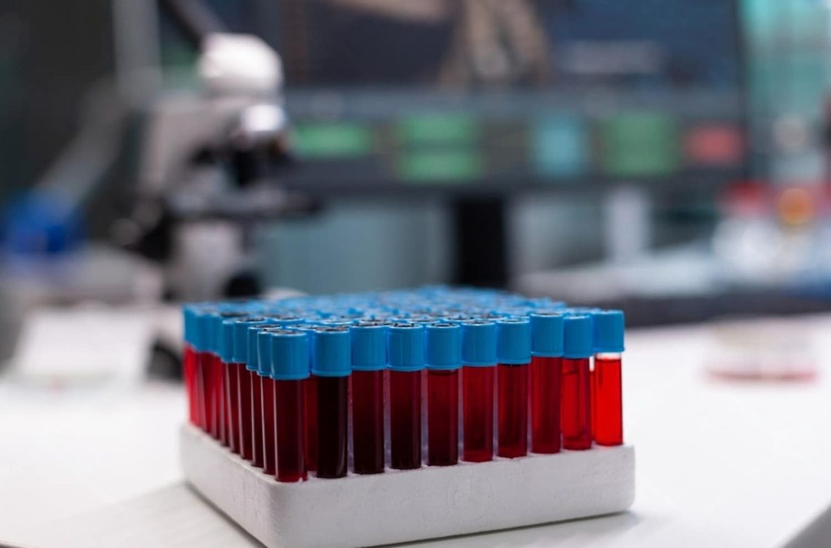 Biospecimen procurement, built for your protocol