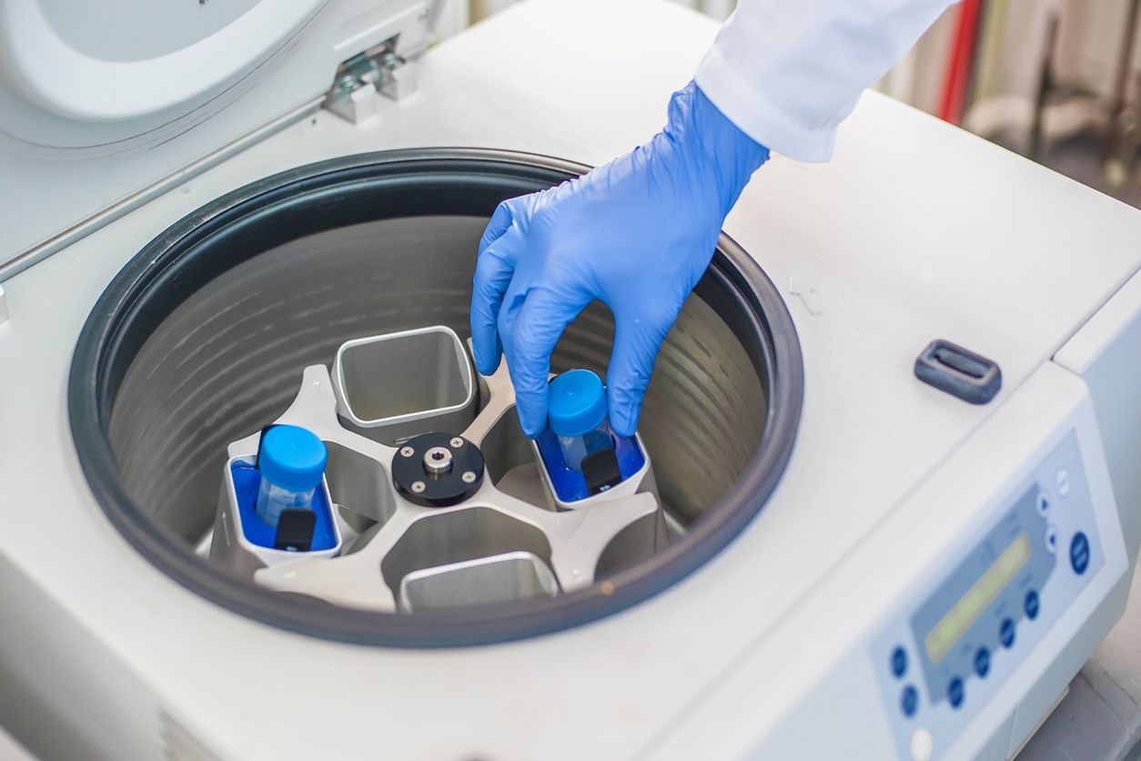 Blood Fractionation